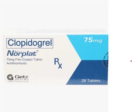 Norplat Tablets 75mg 28s